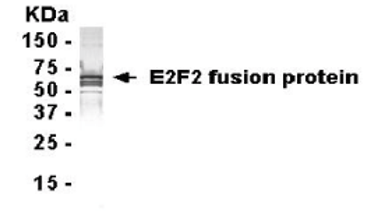 Western Blot: XW-7165 dilution: 1:2, 000. E-coli derived fusion protein as test antigen.