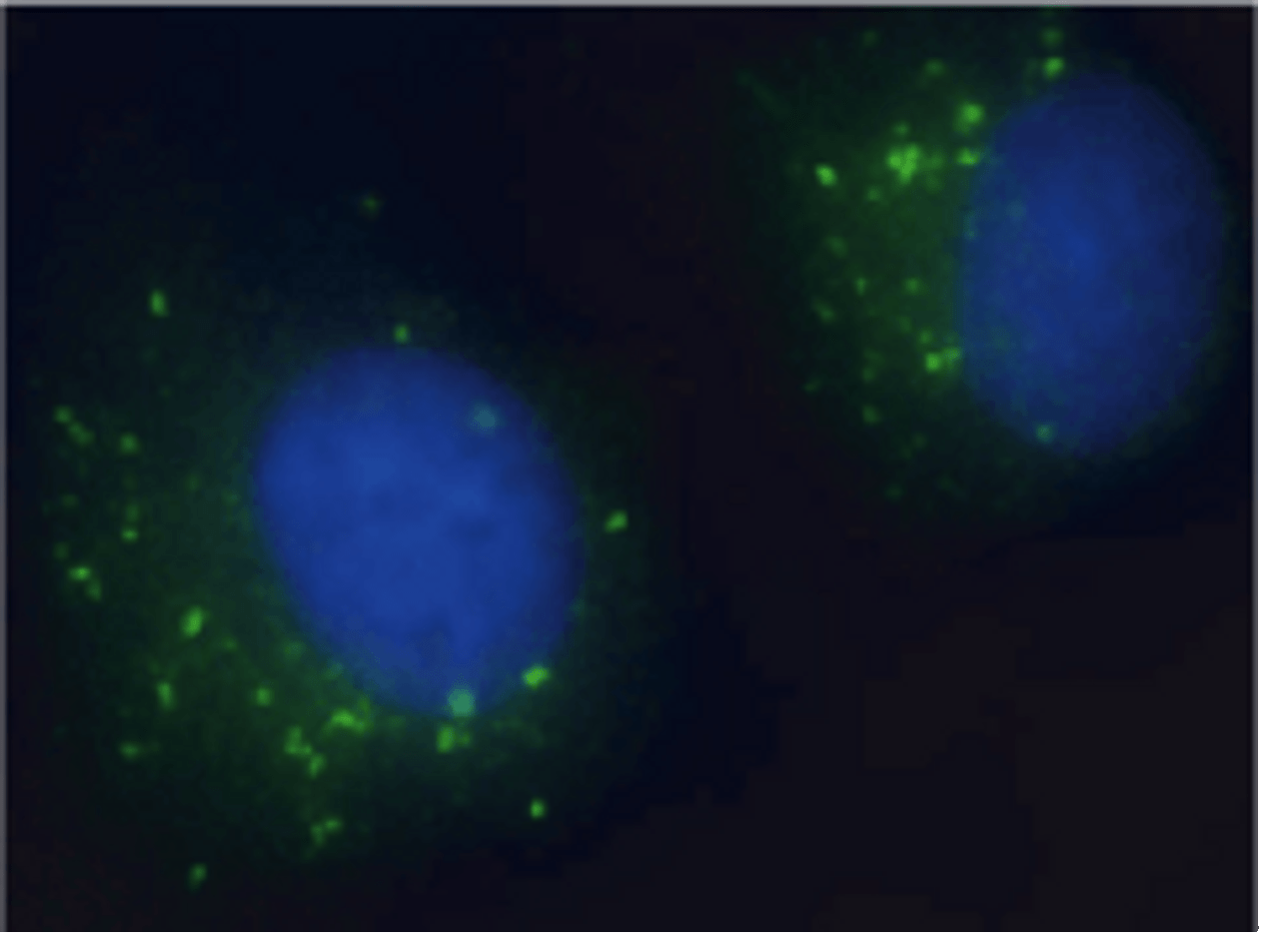 Immunocytochemistry staining of EEA1 antibody.