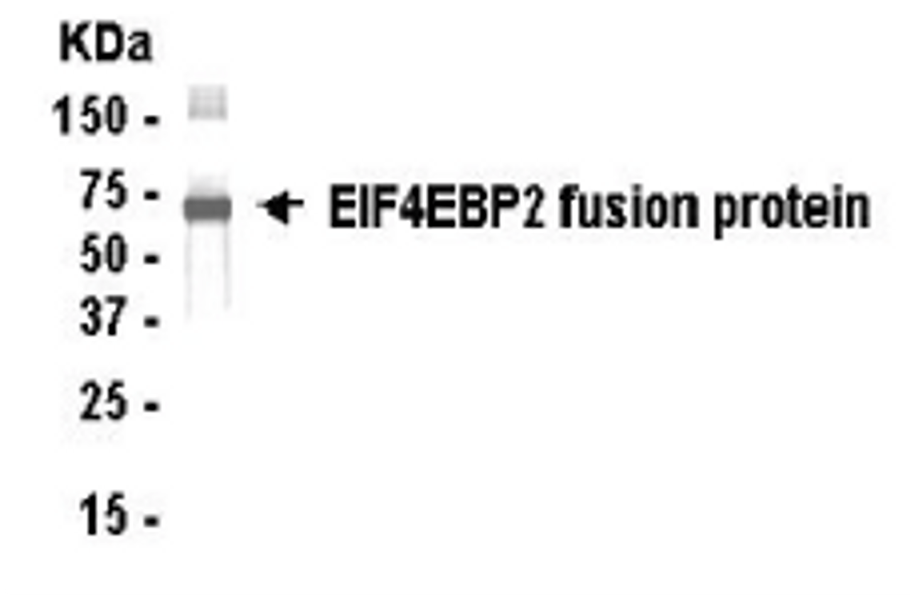 Western Blot: E coli-derived fusion protein as test antigen. XW-7175 dilution: 1:2, 000.