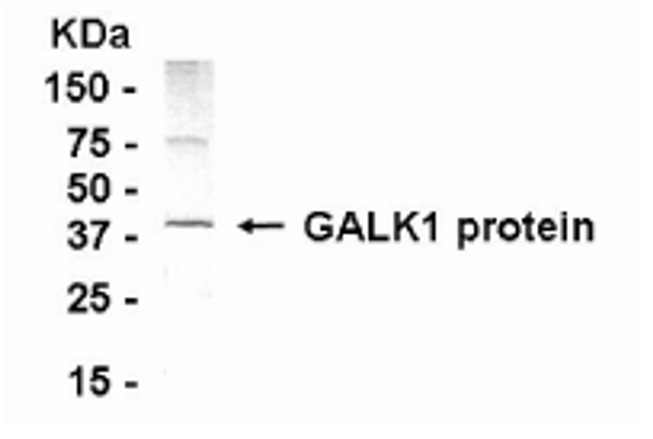 Western blot : Human liver cell lysate as test antigen. Loaded 50ug of protein per lane. Affi-pure IgY dilution: 1/500, Goat anti-IgY-HRP dilution: 1/1000. Colorimetric method for signal development.