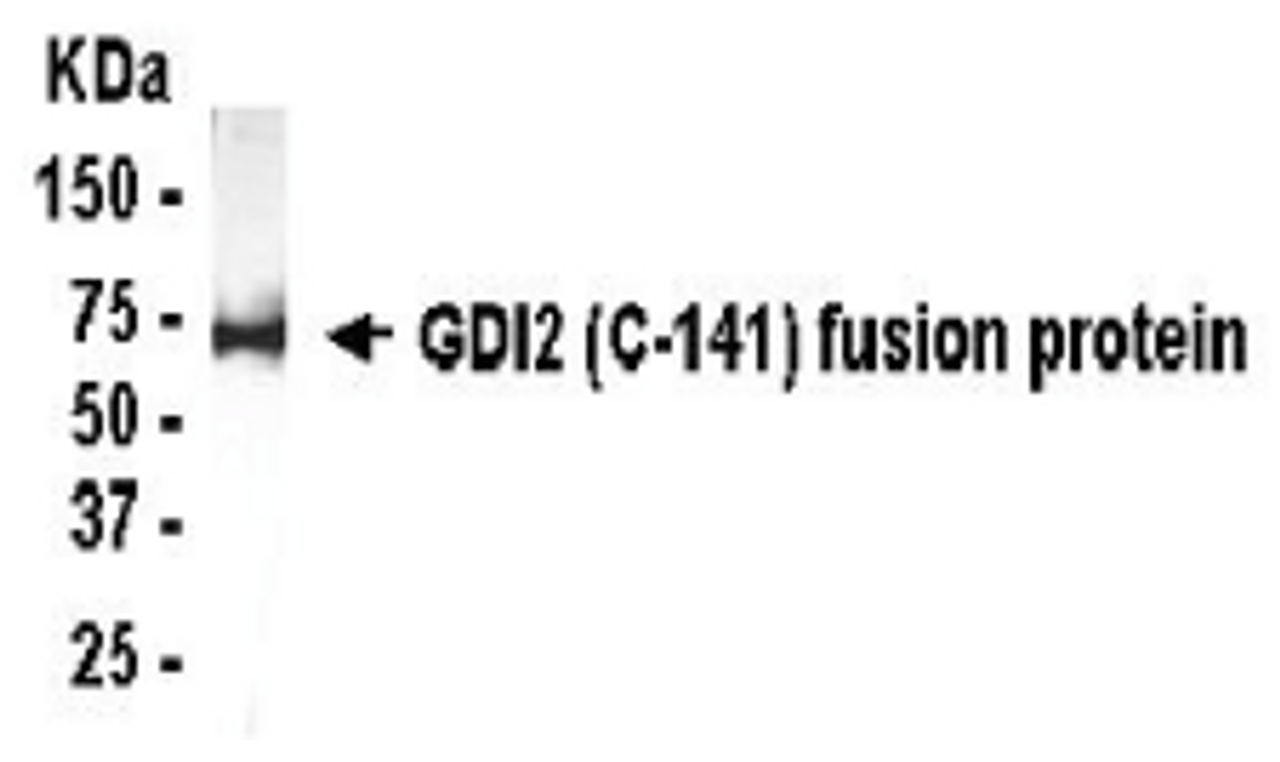 Western Blot: XW-7220 at 1/2000 WB detection of E. coli derived GDI2 fusion protein.