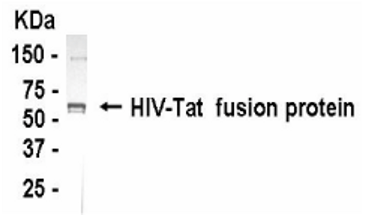 Western blot detection of HIV-Tat antibody.