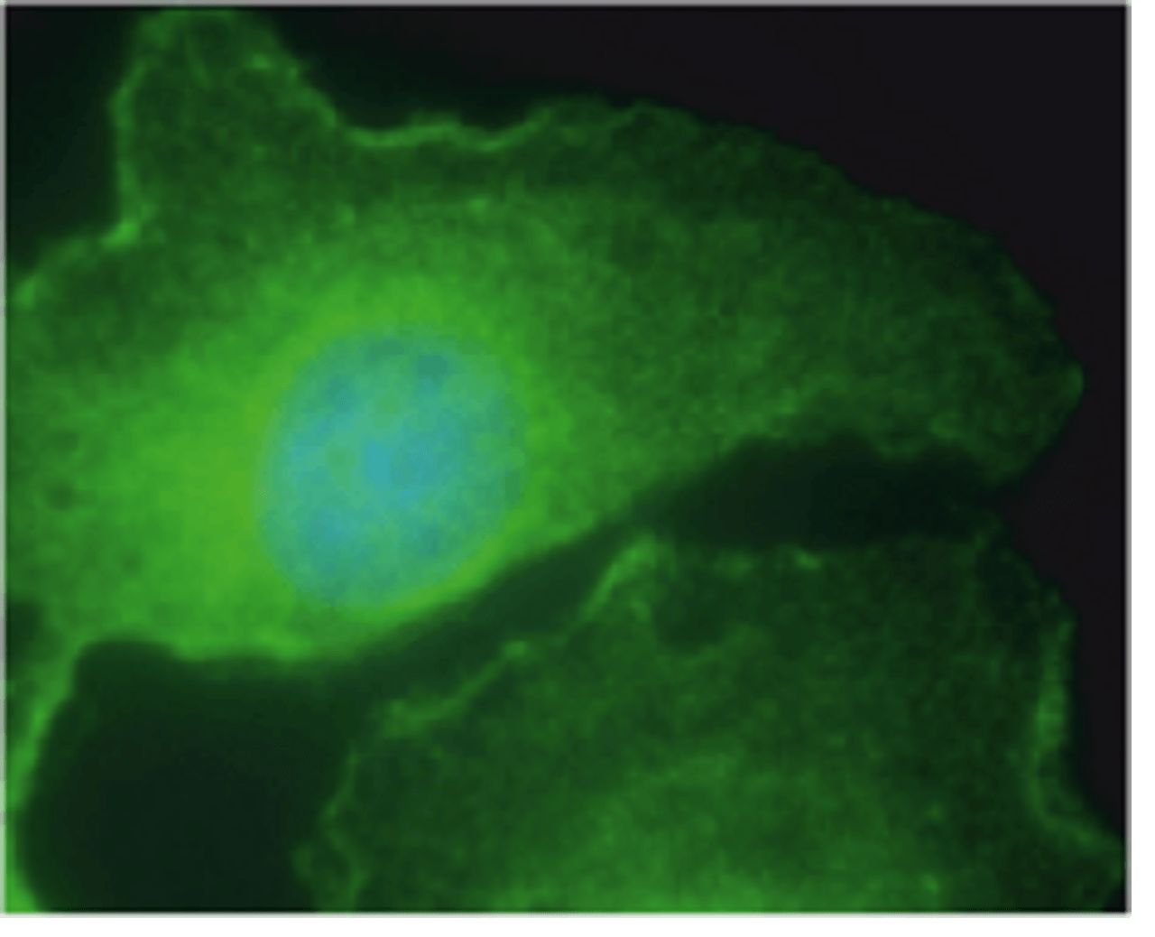 Immunocytochemical staining using M6PR antibody.