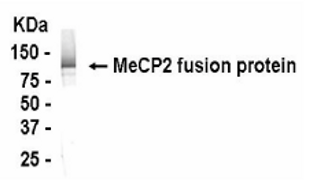 Western blot detection of MeCP2 antibody.