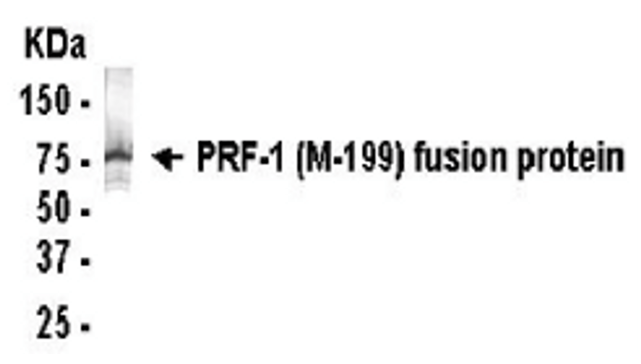 Western blot detection of PRF-1 (M-199) antibody.