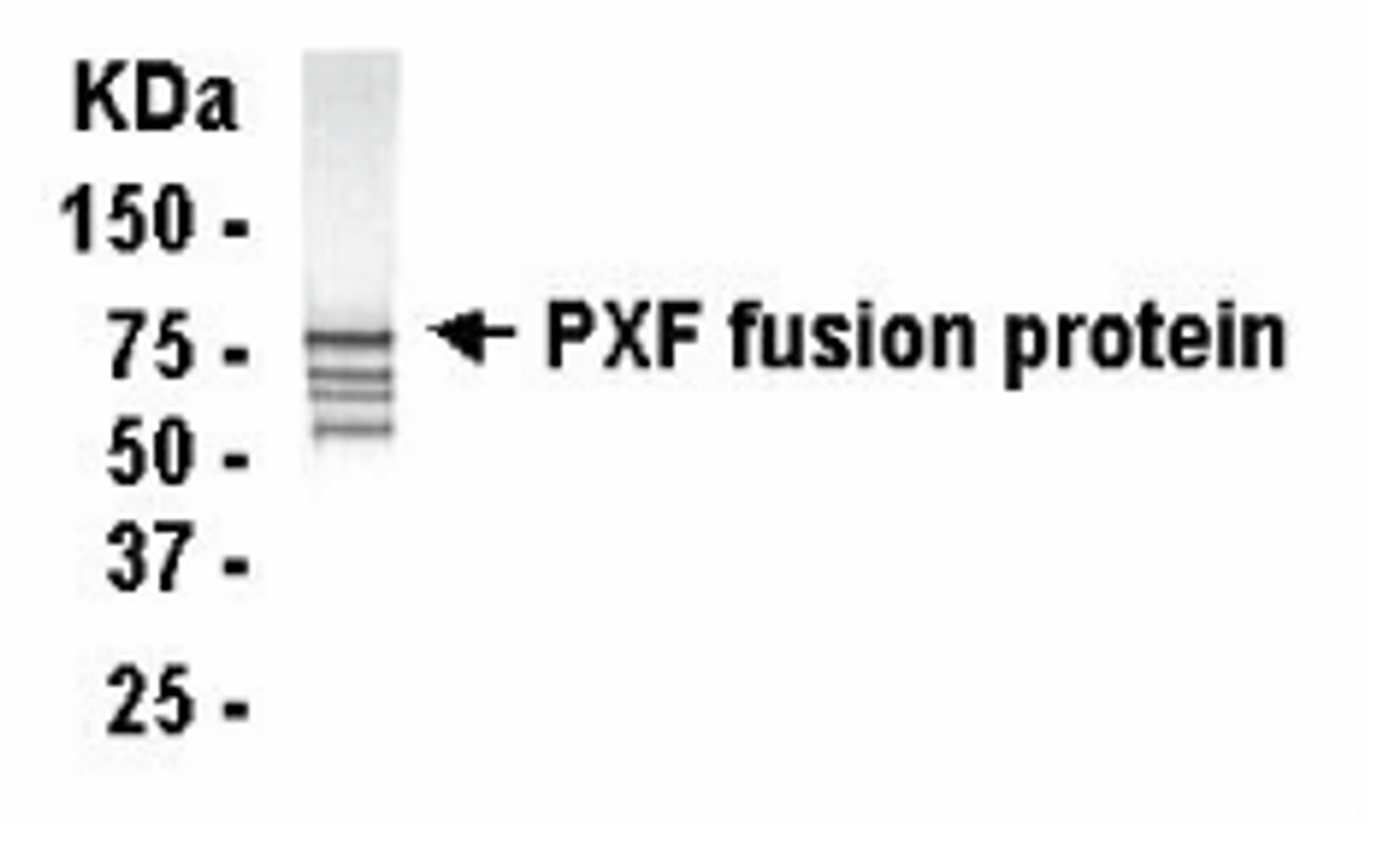 Western Blot analysis of PEX19. E. coli derived fusion protein as test antigen. XW-7504 at 1/2000. The top band (80kD) represents PEX19. The lower bands probably represent degradation products.