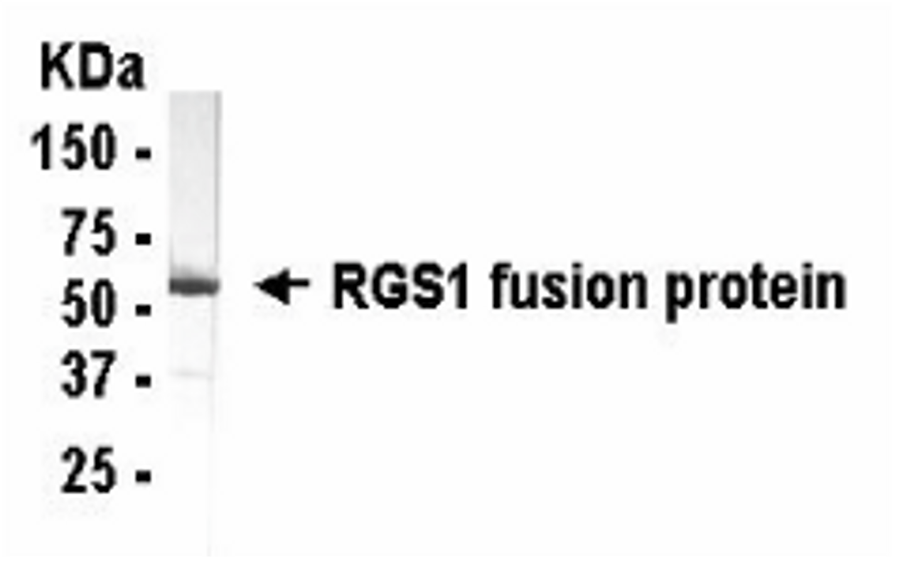 Western Blot using E coli-derived fusion protein as test antigen. Affi-anti-RGS1 IgY dilution: 1:2000, Goat anti-IgY-HRP dilution: 1:1000. Colorimetric method for signal development. Predicted band size : 24 kDa