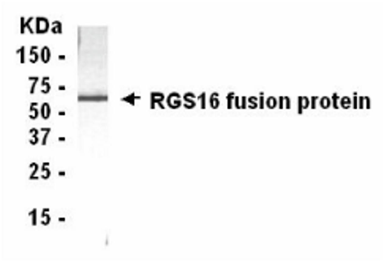 Western blot: E coli-derived fusion protein as test antigen. XW-7526 dilution: 1:2, 000.