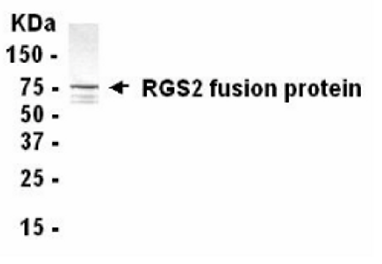 Western blot analysis of E coli derived RGS2 fusion protein using XW-7531 at 1/2000. Predicted band size : 24 kDa