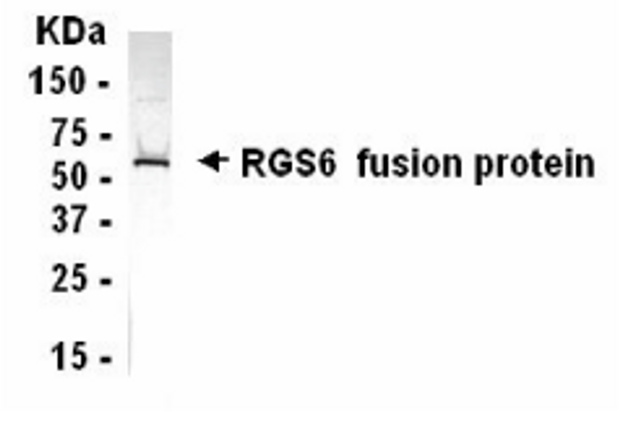 Western blot analysis of E coli derived RGS6 fusion protein using XW-7535 at 1/2000.