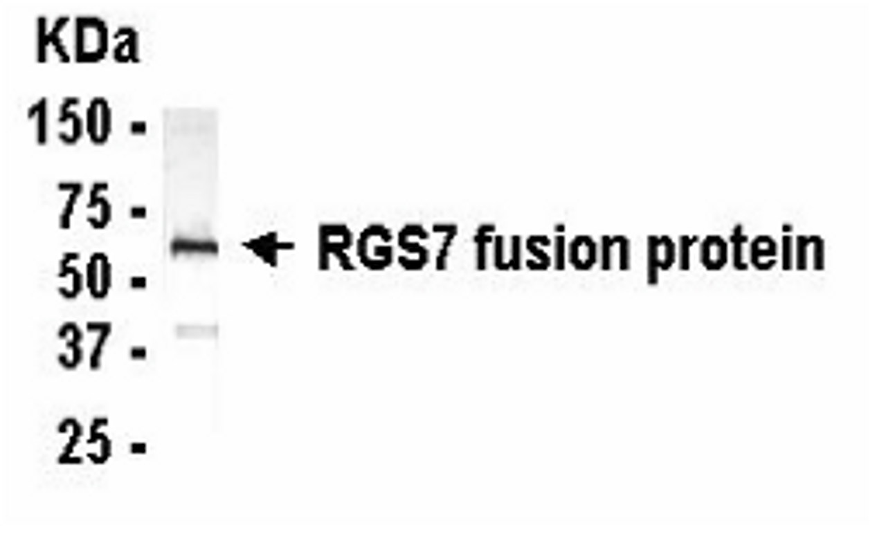 Western Blot: E coli-derived fusion protein as test antigen. XW-7536 dilution: 1:2, 000.