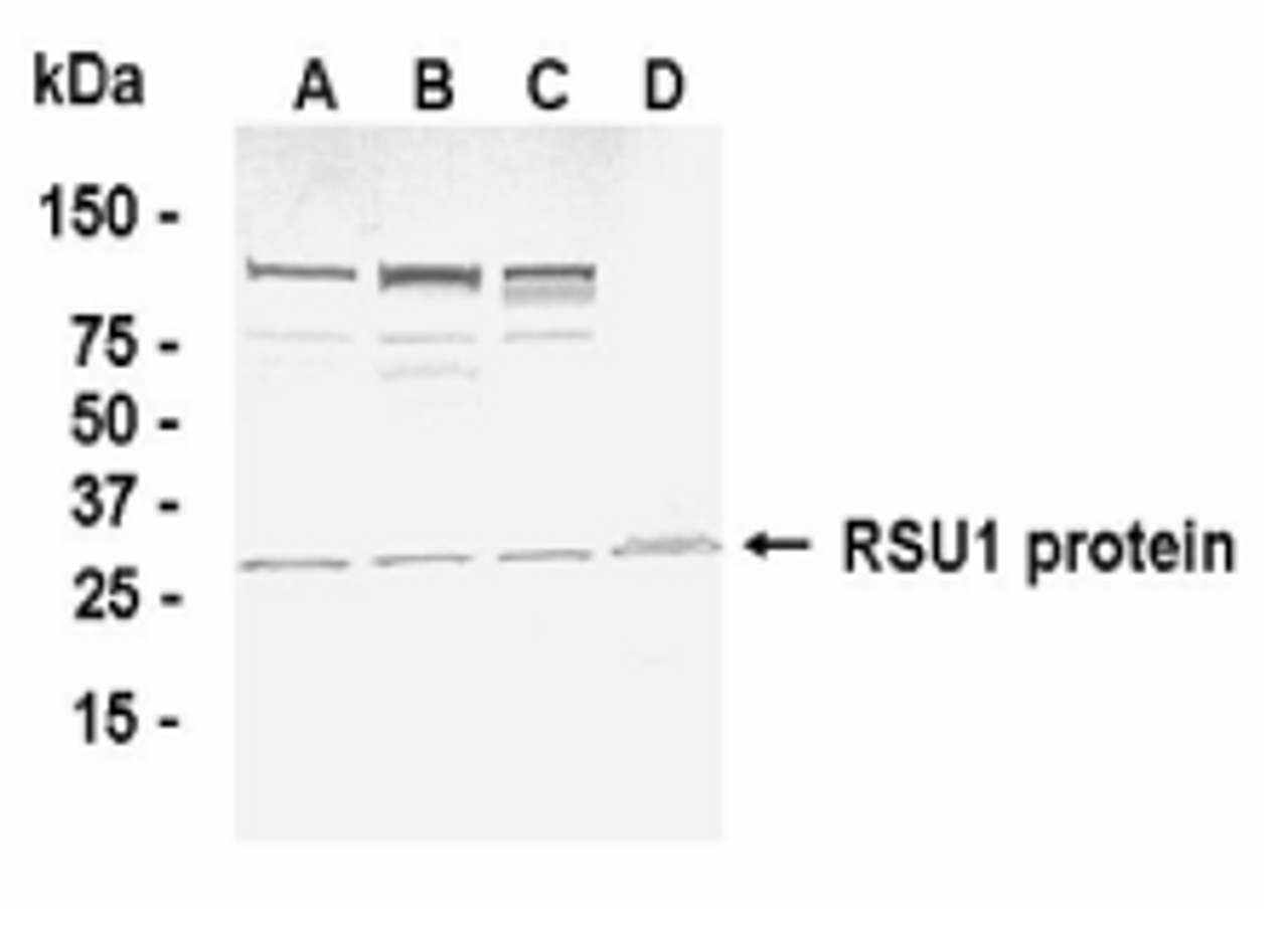 Western blot detection of RSU1 antibody.
