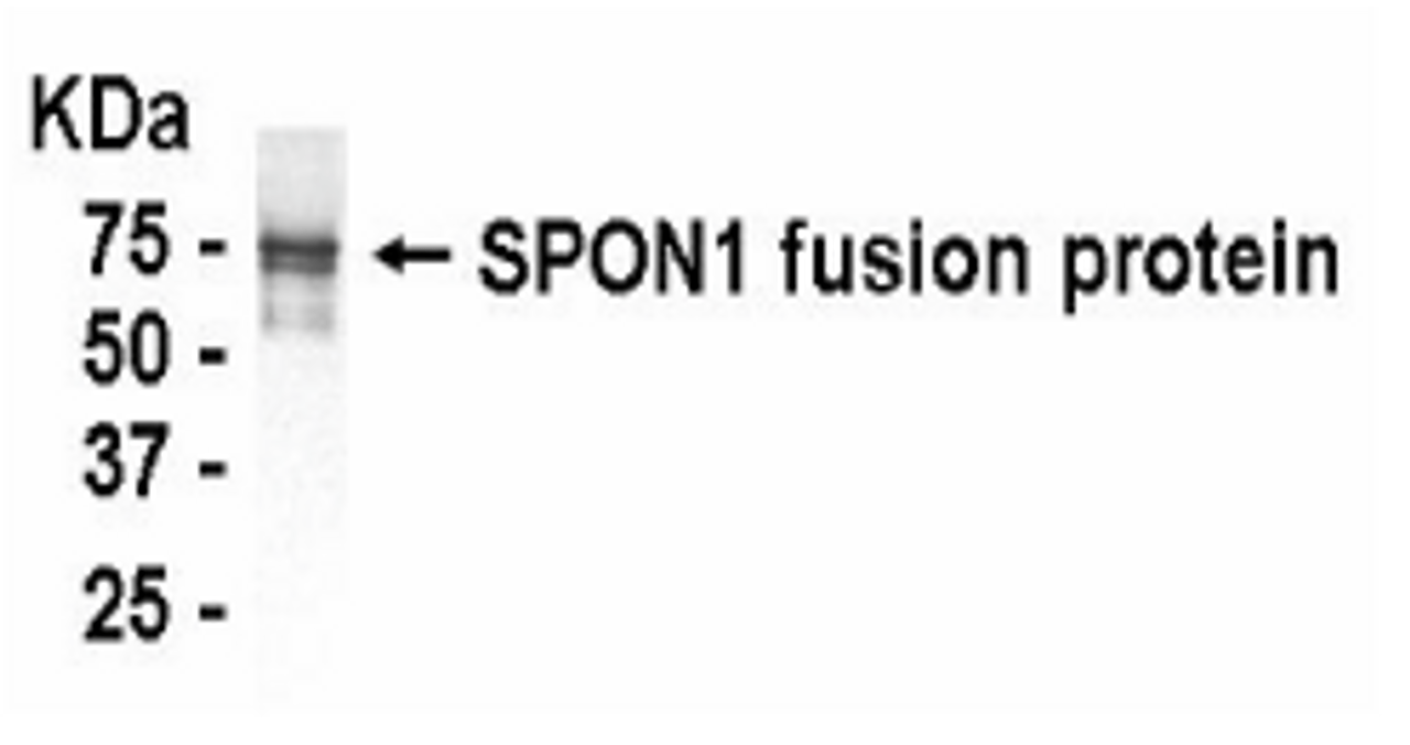 Western Blot analysis of SPON1 using XW-7587 at a 1:2, 000 dilution. E coli-derived fusion protein as test antigen.