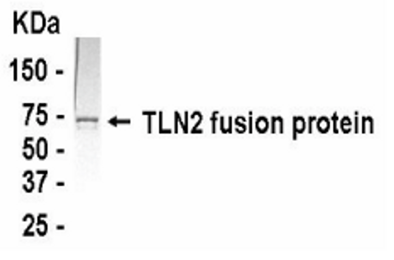 Western Blot: XW-7621 dilution: 1:2, 000. Goat anti-GTX14274 HRP dilution 1:1, 000. E coli-derived fusion protein as test antigen.