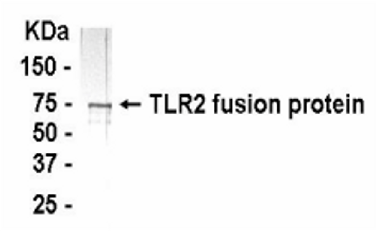 Western Blot: E coli-derived fusion protein as test antigen. XW-7622 dilution: 1:2, 000 and Goat anti-IgY-HRP dilution: 1:1, 000.