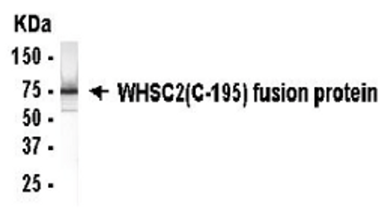 Western Blot: E coli derived fusion protein as test antigen. XW-7655 dilution: 1:2000. Colorimetric method for signal development.