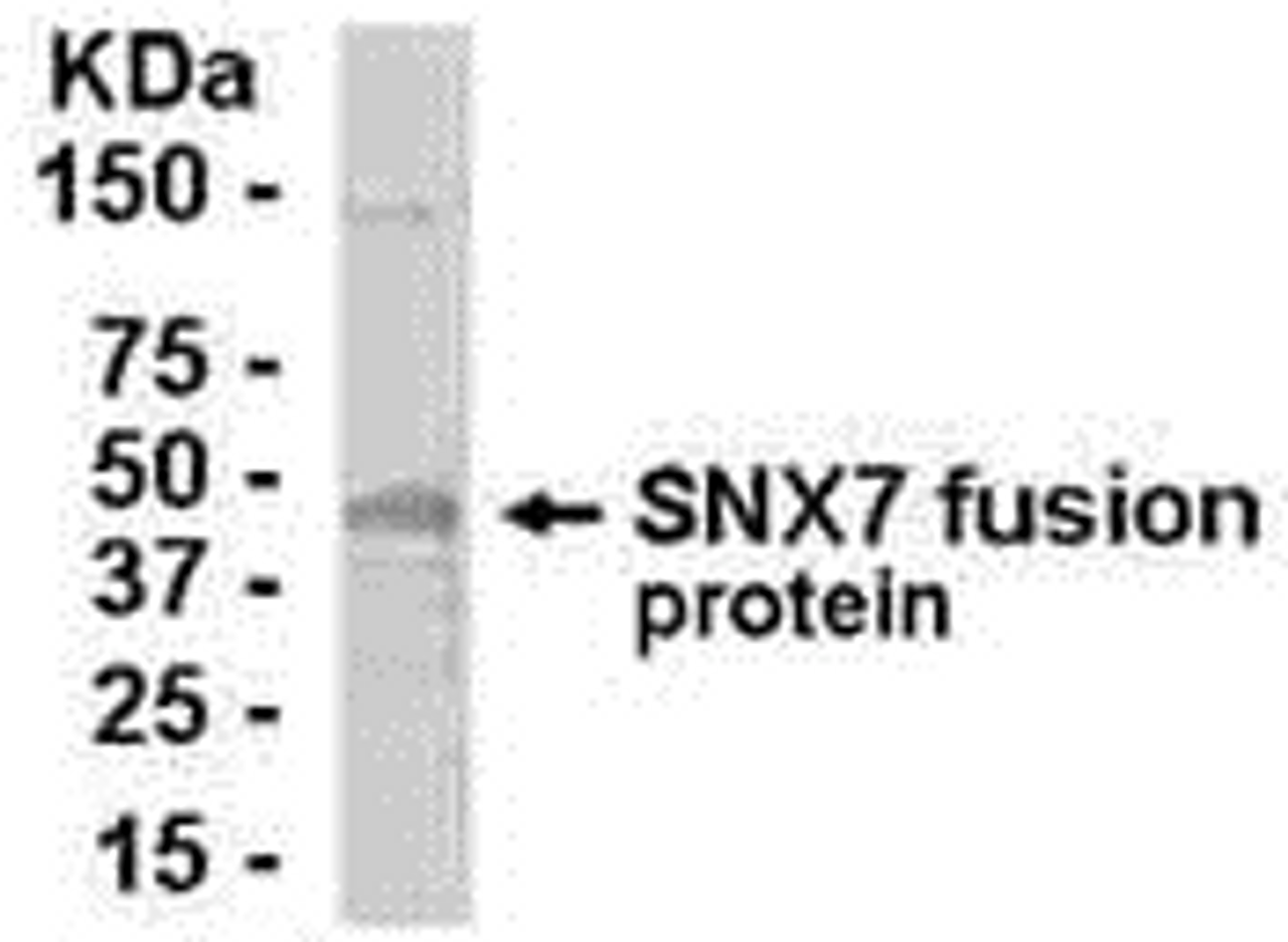 E coli-derived fusion protein as test antigen. Affinity-purified IgY dilution: 1:2000, Goat anti-IgY-HRP dilution: 1:1000. Colorimetric method for signal development.