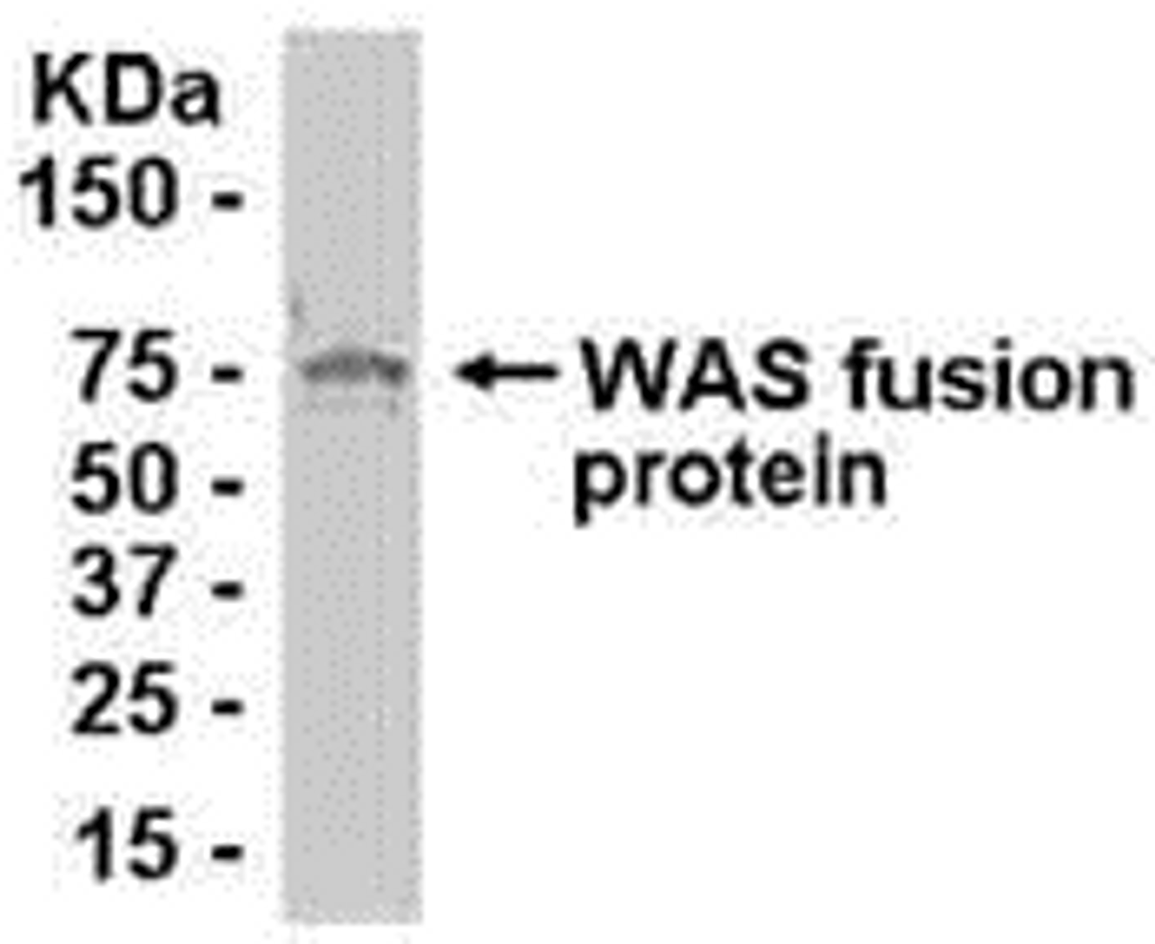 E coli-derived fusion protein as test antigen. Affinity-purified IgY dilution: 1:2000, Goat anti-IgY-HRP dilution: 1:1000. Colorimetric method for signal development.