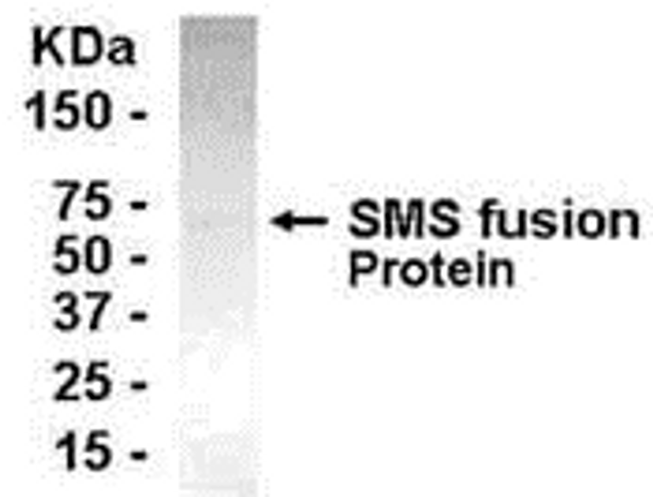 E coli-derived fusion protein as test antigen. Affinity-purified IgY dilution: 1:2000, Goat anti-IgY-HRP dilution: 1:1000. Colorimetric method for signal development.