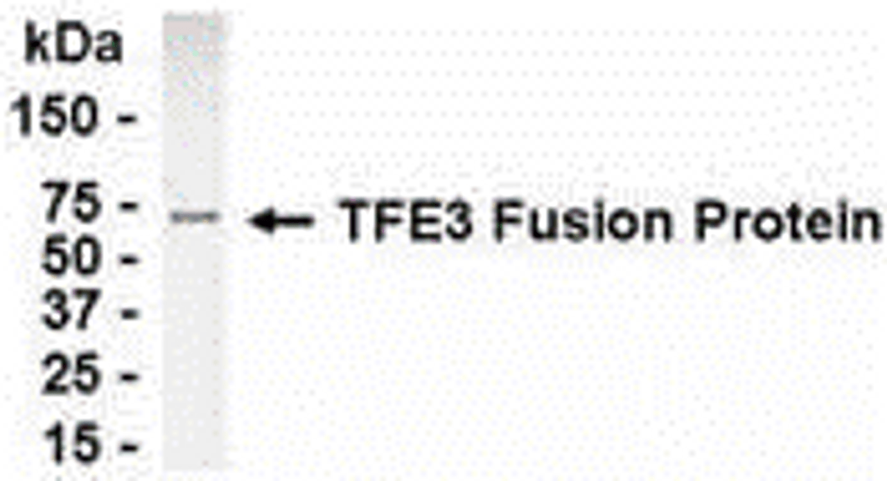 E coli-derived fusion protein as test antigen. Affinity-purified IgY dilution: 1:2000, Goat anti-IgY-HRP dilution: 1:1000. Colorimetric method for signal development.