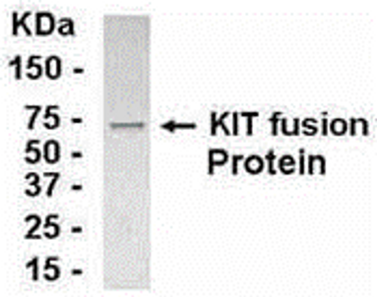 E coli-derived fusion protein as test antigen. Affinity-purified IgY dilution: 1:2000, Goat anti-IgY-HRP dilution: 1:1000. Colorimetric method for signal development.