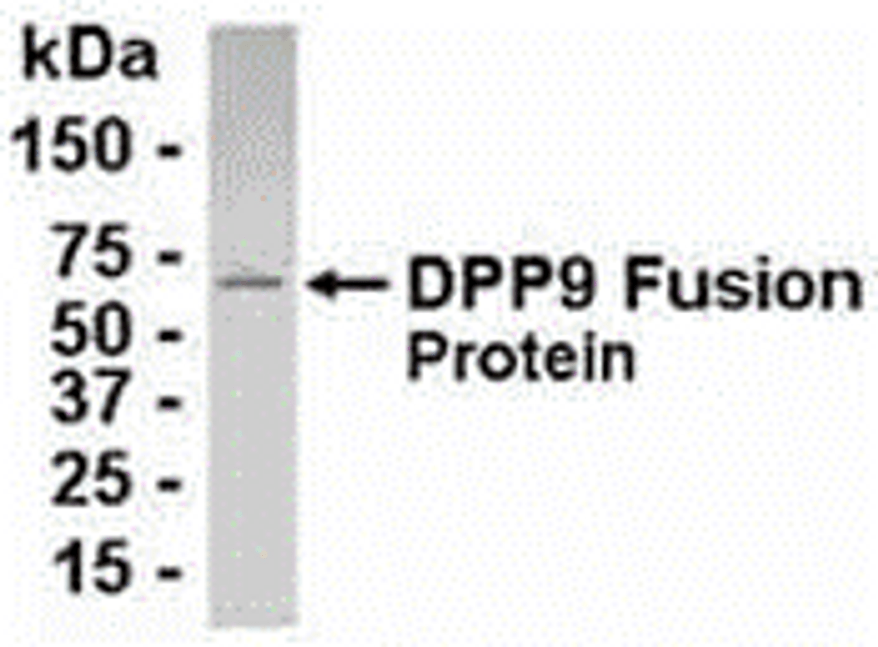 E coli-derived fusion protein as test antigen. Affinity-purified IgY dilution: 1:2000, Goat anti-IgY-HRP dilution: 1:1000. Colorimetric method for signal development.