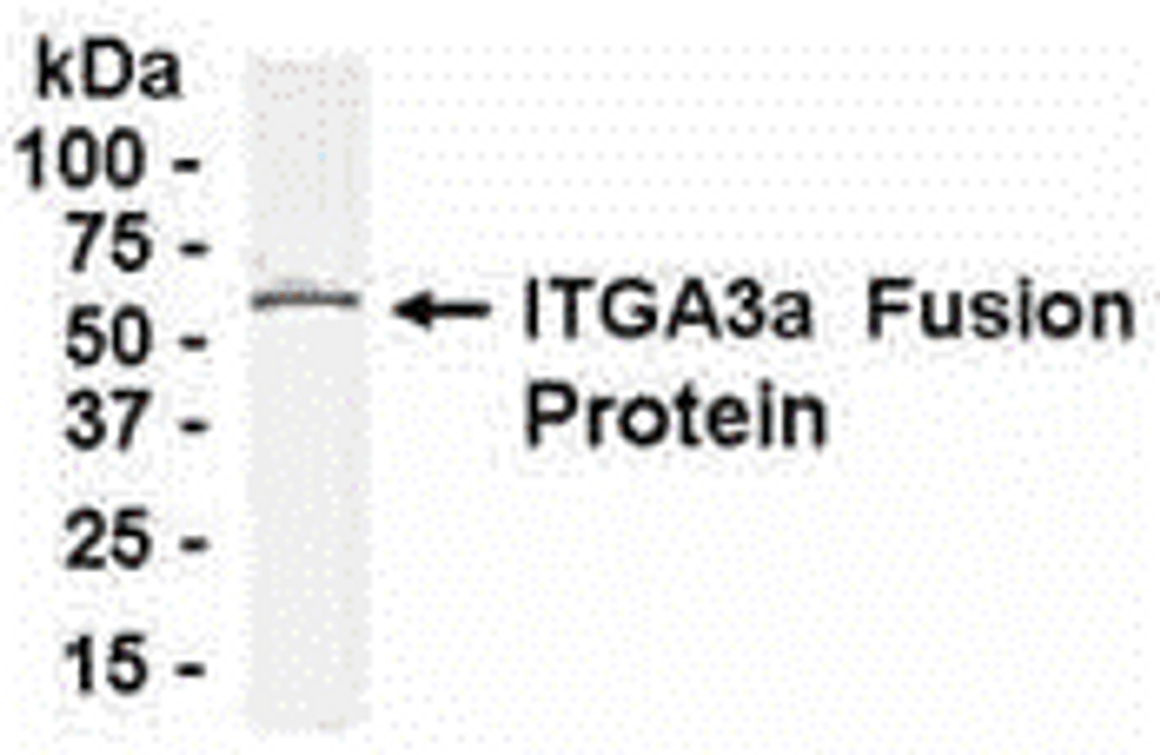 E coli-derived fusion protein as test antigen. Affinity-purified IgY dilution: 1:2000, Goat anti-IgY-HRP dilution: 1:1000. Colorimetric method for signal development.