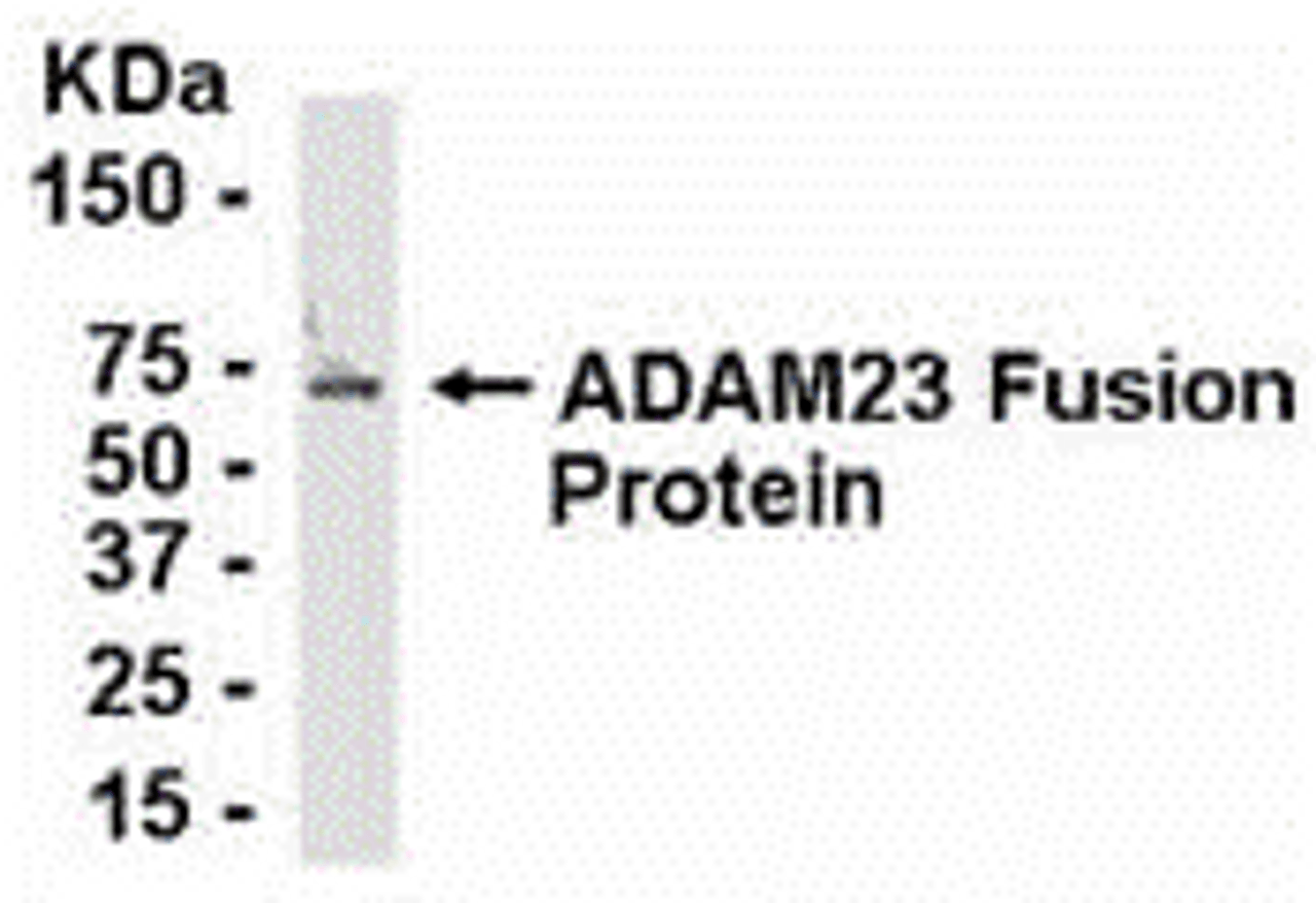 E coli-derived fusion protein as test antigen. Affinity-purified IgY dilution: 1:2000, Goat anti-IgY-HRP dilution: 1:1000. Colorimetric method for signal development.