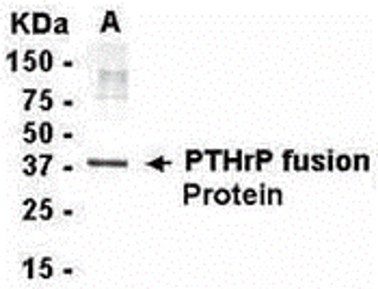 E coli-derived fusion protein as test antigen. Affinity-Purified IgY dilution: 1:2000, Goat anti-IgY-HRP dilution: 1:1000. Colorimetric method for signal development.