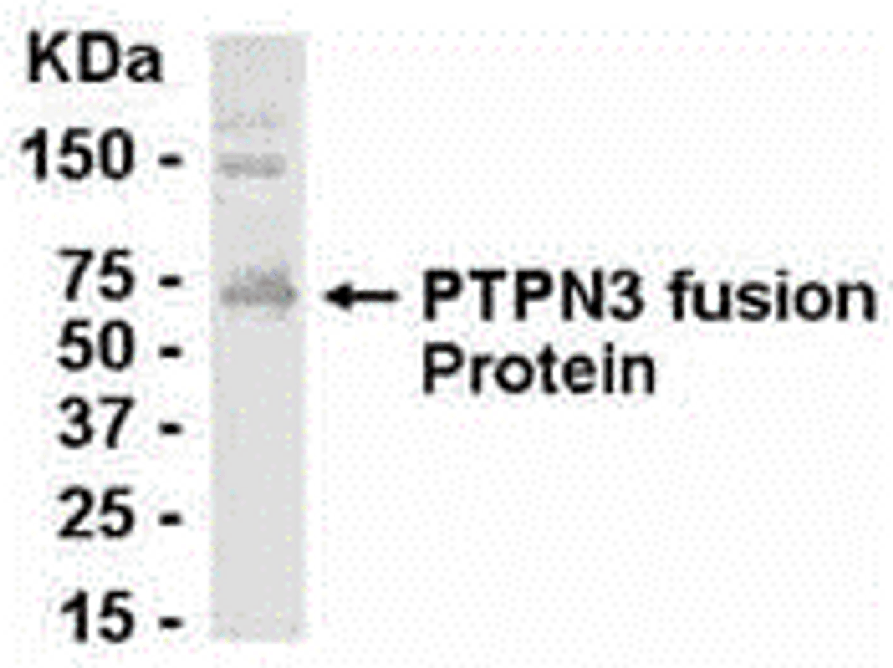 E coli-derived fusion protein as test antigen. Affinity-purified IgY dilution: 1:2000, Goat anti-IgY-HRP dilution: 1:1000. Colorimetric method for signal development.