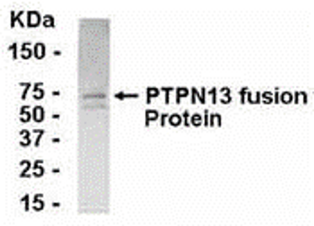 E coli-derived fusion protein as test antigen. Affinity-purified IgY dilution: 1:2000, Goat anti-IgY-HRP dilution: 1:1000. Colorimetric method for signal development.