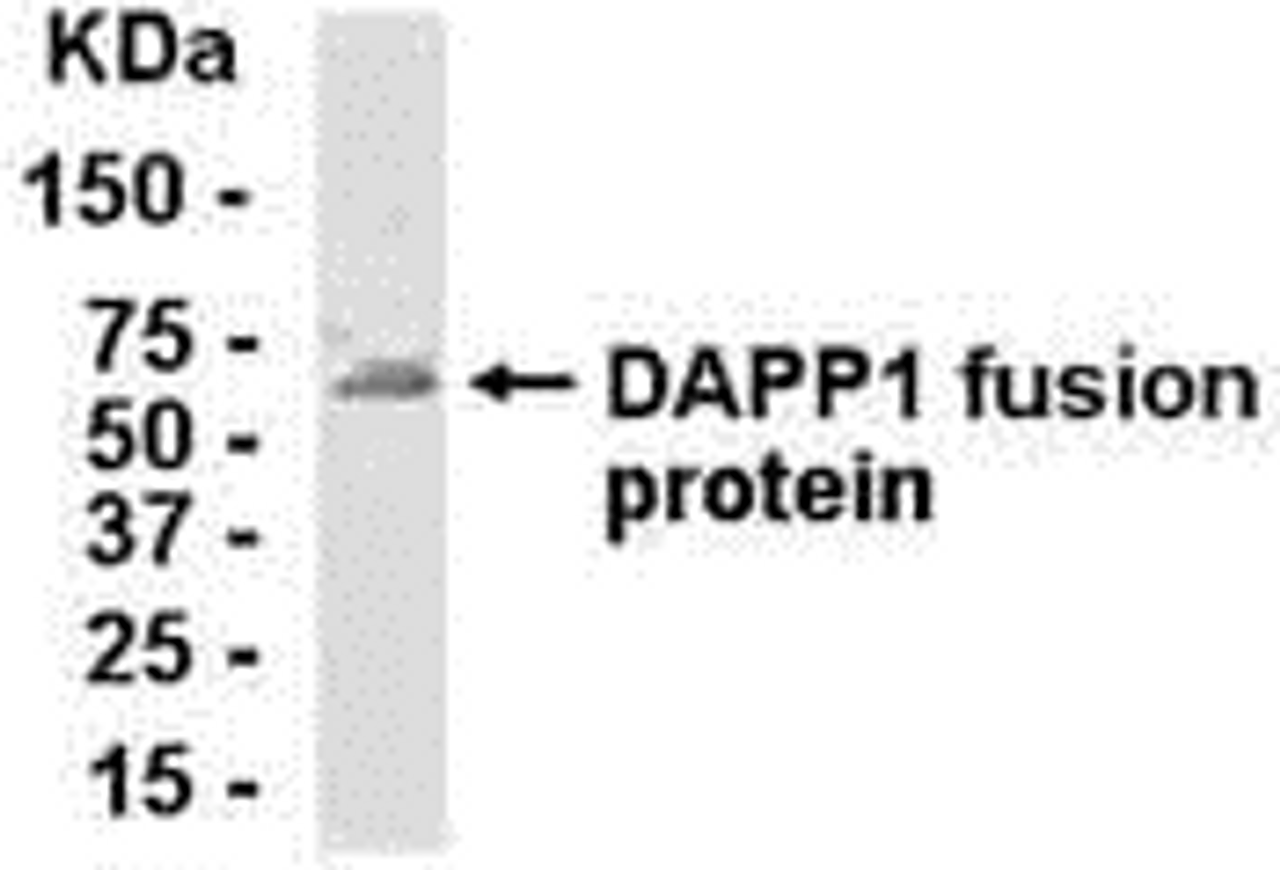 E coli-derived fusion protein as test antigen. Affinity-purified IgY dilution: 1:2000, Goat anti-IgY-HRP dilution: 1:1000. Colorimetric method for signal development.