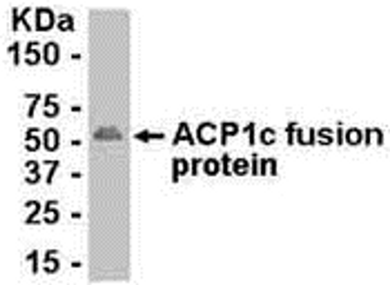 E coli-derived fusion protein as test antigen. Affinity-purified IgY dilution: 1:2000, Goat anti-IgY-HRP dilution: 1:1000. Colorimetric method for signal development.