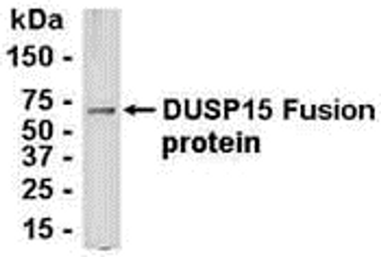 E coli-derived fusion protein as test antigen. Affinity-purified IgY dilution: 1:2000, Goat anti-IgY-HRP dilution: 1:1000. Colorimetric method for signal development.