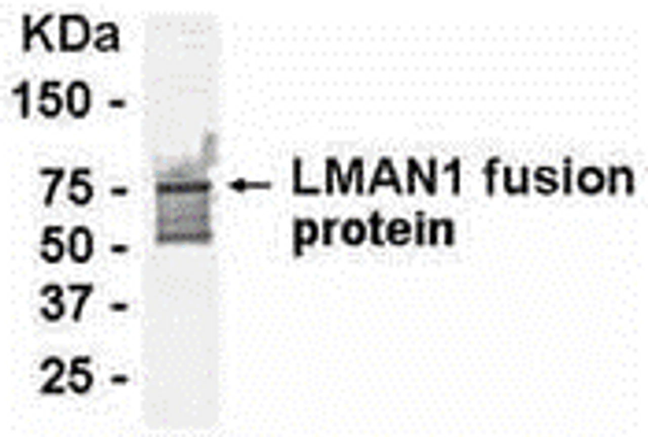 E coli-derived fusion protein as test antigen. Affinity-purified IgY dilution: 1:2000, Goat anti-IgY-HRP dilution: 1:1000. Colorimetric method for signal development.