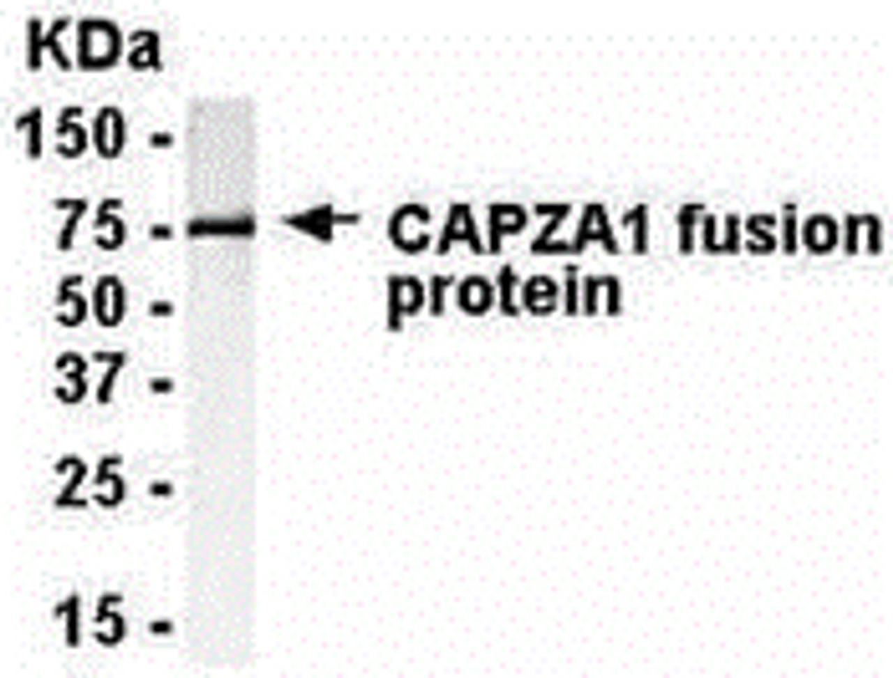 E coli-derived fusion protein as test antigen. anti-CAPZA1 IgY dilution: 1:2000, Goat anti-IgY-HRP dilution: 1:1000. Colorimetric method for signal development.
