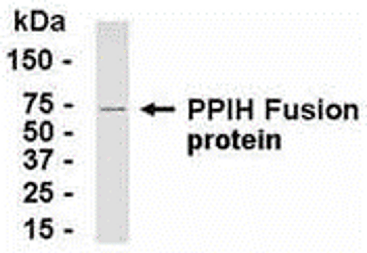 E coli-derived fusion protein as test antigen. Affinity-purified IgY dilution: 1:2000, Goat anti-IgY-HRP dilution: 1:1000. Colorimetric method for signal development.