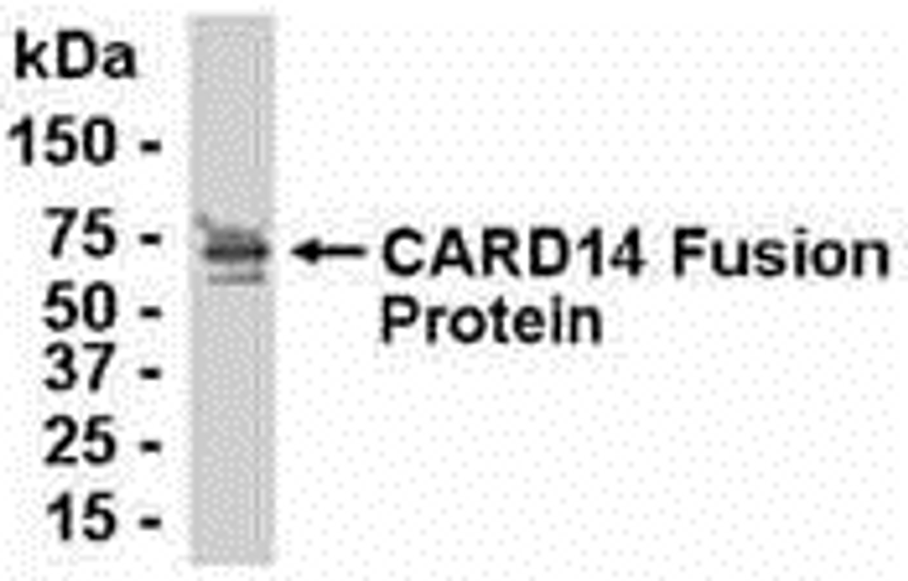 E coli-derived fusion protein as test antigen. Affinity-purified IgY dilution: 1:2000, Goat anti-IgY-HRP dilution: 1:1000. Colorimetric method for signal development.