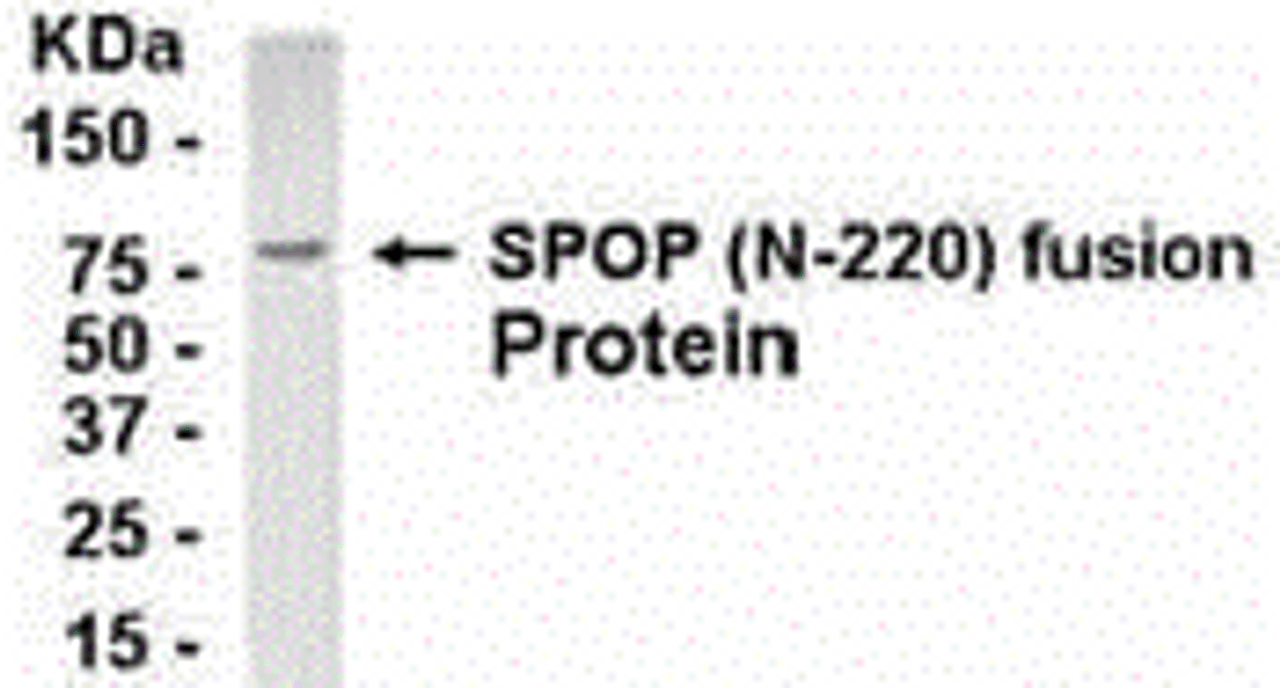 E coli-derived fusion protein as test antigen. Affinity-purified IgY dilution: 1:2000, Goat anti-IgY-HRP dilution: 1:1000. Colorimetric method for signal development.