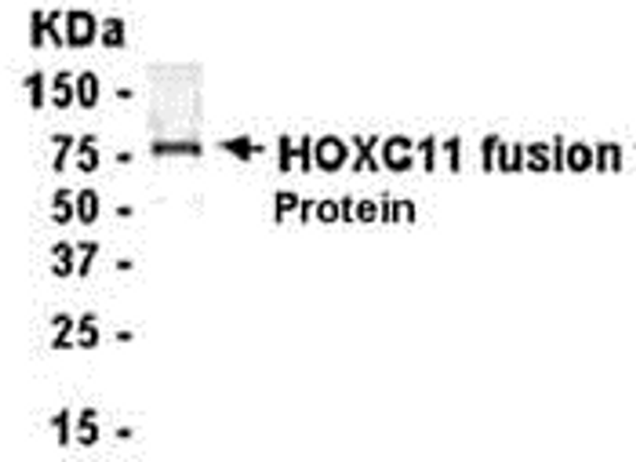 E coli-derived fusion protein as test antigen. Affinity-purified IgY dilution: 1:2000, Goat anti-IgY-HRP dilution: 1:1000. Colorimetric method for signal development.