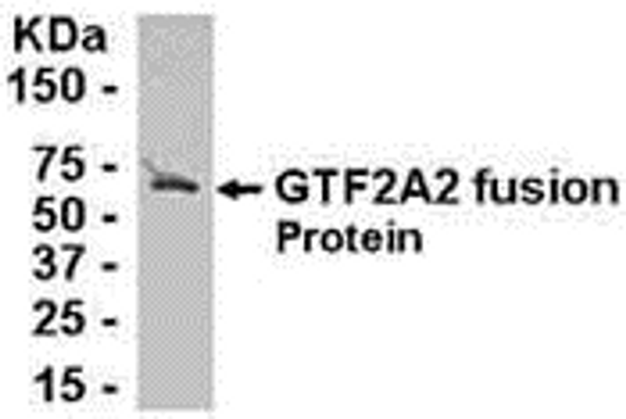 E coli-derived fusion protein as test antigen. Affinity-purified IgY dilution: 1:2000, Goat anti-IgY-HRP dilution: 1:1000. Colorimetric method for signal development.