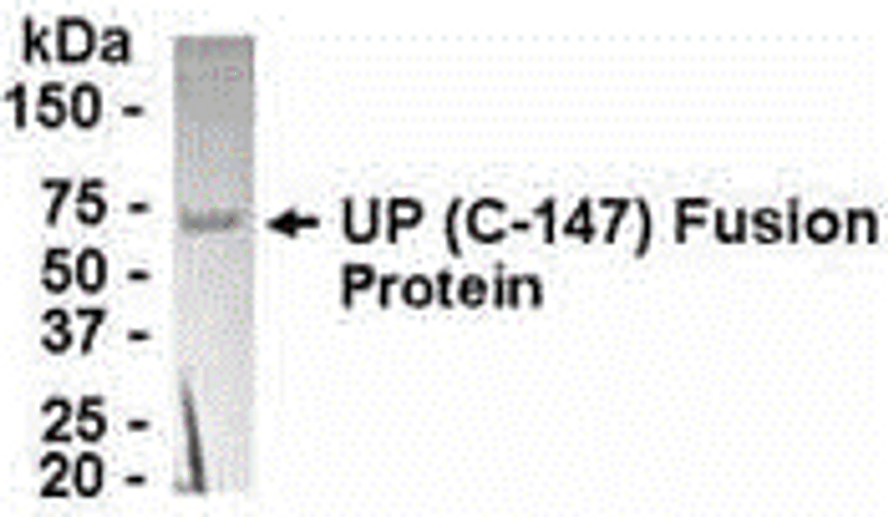 E coli-derived fusion protein as test antigen. Affinity-purified IgY dilution: 1:2000, Goat anti-IgY-HRP dilution: 1:1000. Colorimetric method for signal development.