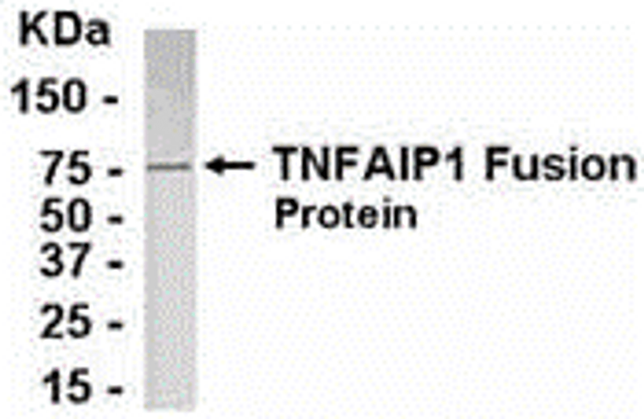 Direct Elisa Test. Protein as test antigen. Affi-pure IgY as primary antibody and Goat anti-IgY HRP as 2nd antibody. Fixed amount of antibody (1 ug/mL) and serial dilutions of antigen. <br><br>E coli-derived fusion protein as test antigen. Affinity-purified IgY dilution: 1:2000, Goat anti-IgY-HRP dilution: 1:1000. Colorimetric method for signal development.