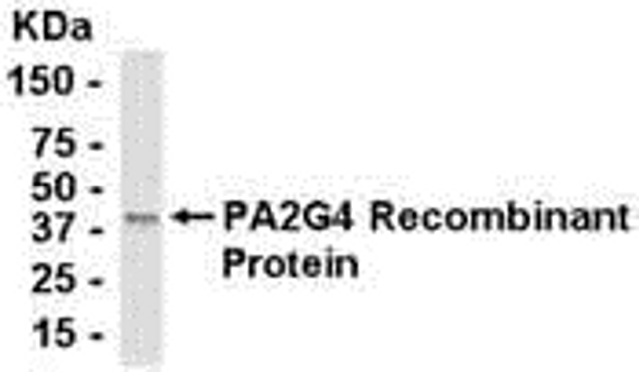 E coli-derived fusion protein as test antigen. Affinity-purified IgY dilution: 1:2000, Goat anti-IgY-HRP dilution: 1:1000. Colorimetric method for signal development.