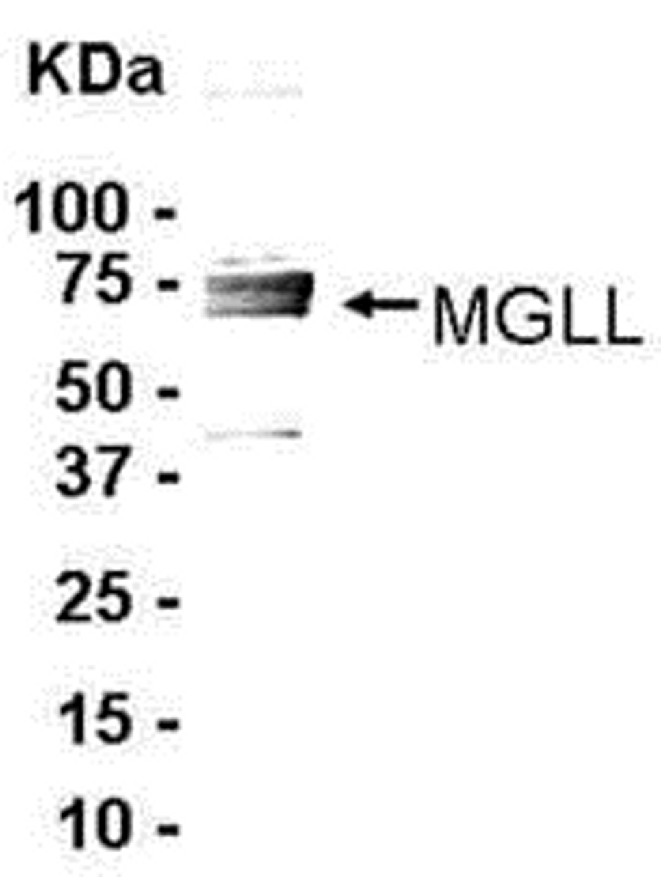 E coli-derived fusion protein as test antigen. Affinity-purified IgY dilution: 1:2000, Goat anti-IgY-HRP dilution: 1:1000. Colorimetric method for signal development.