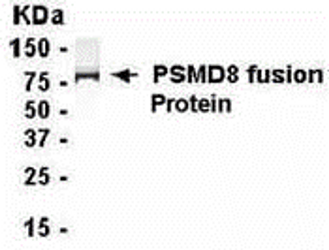 E coli-derived fusion protein as test antigen. Affinity-purified IgY dilution: 1:2000, Goat anti-IgY-HRP dilution: 1:1000. Colorimetric method for signal development.