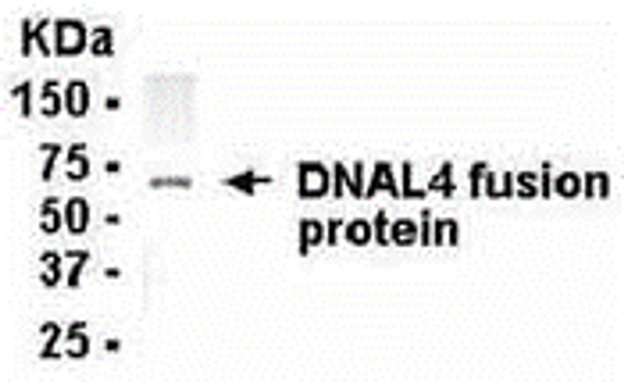 E coli-derived fusion protein as test antigen. Affi-pure IgY dilution: 1:2000, Goat anti-IgY-HRP dilution: 1:1000. Colorimetric method for signal development.