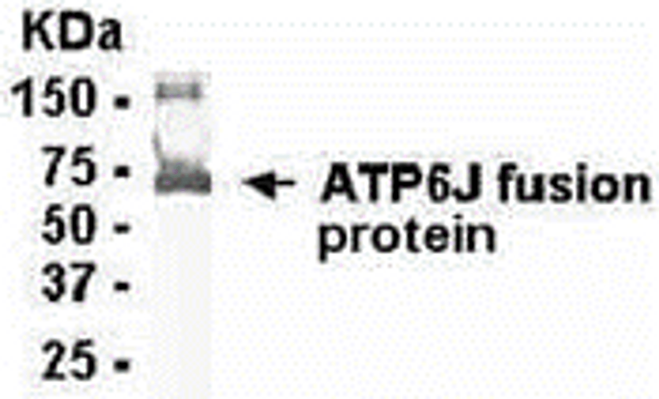 E coli-derived fusion protein as test antigen. Affinity-purified IgY dilution: 1:2000, Goat anti-IgY-HRP dilution: 1:1000. Colorimetric method for signal development.