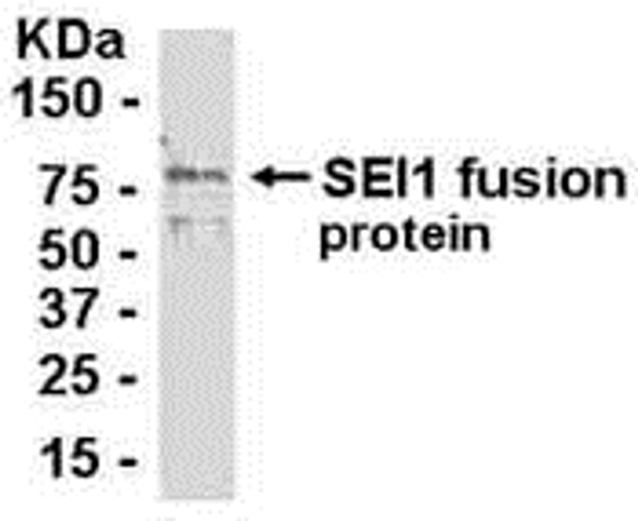 E coli-derived fusion protein as test antigen. Affinity-purified IgY dilution: 1:2000, Goat anti-IgY-HRP dilution: 1:1000. Colorimetric method for signal development.