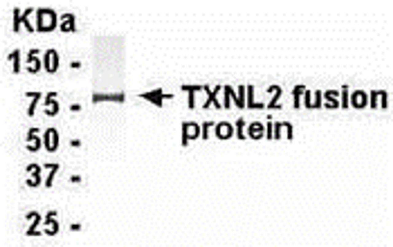 E coli-derived fusion protein as test antigen. Affinity-purified IgY dilution: 1:2000, Goat anti-IgY-HRP dilution: 1:1000. Colorimetric method for signal development.